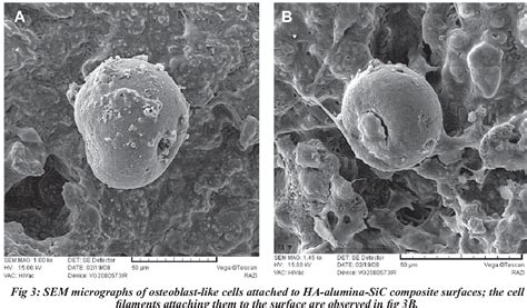 Hydroxyapatite, Un Champion De La Biocompatibilité Et Du Renforcement Osseux!