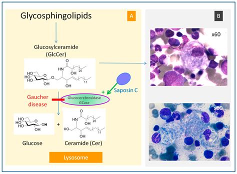  Imiglucerase: Un Biocatalyseur révolutionnaire pour le Traitement des Maladies Lysosomales!